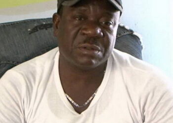 Mr Ibu suffers amputation, family says it is to keep him alive
