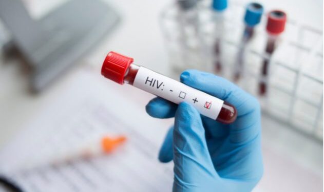 New hope as trial of HIV vaccine begins