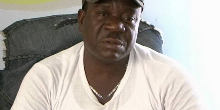 Mr Ibu suffers amputation, family says it is to keep him alive